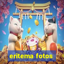 eritema fotos